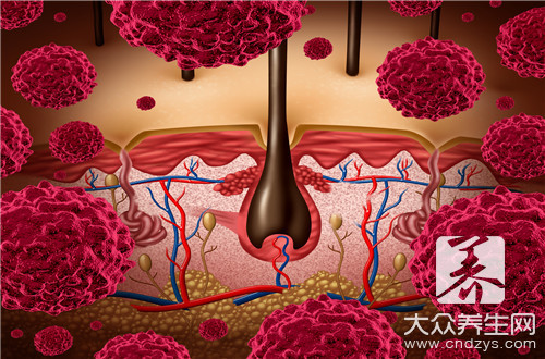 大腿汗毛毛孔小红点