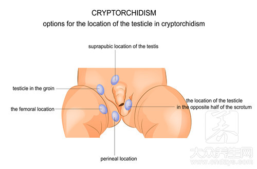 睾丸坠痛的原因是什么呢